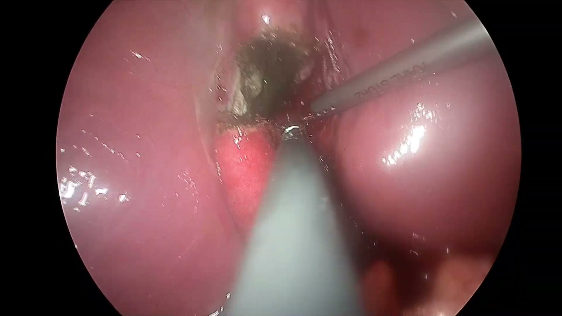 surgical still