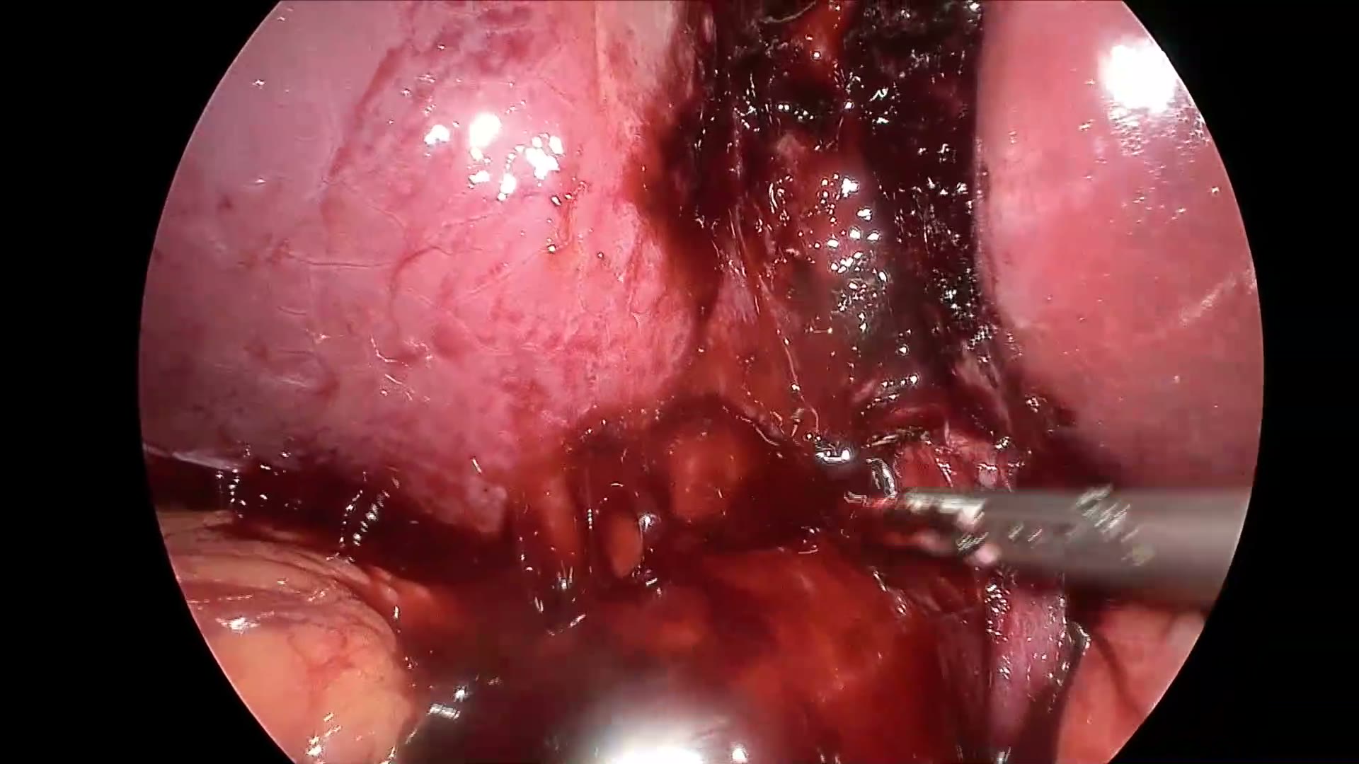 surgical still
