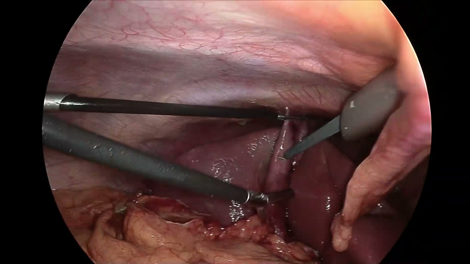surgical still