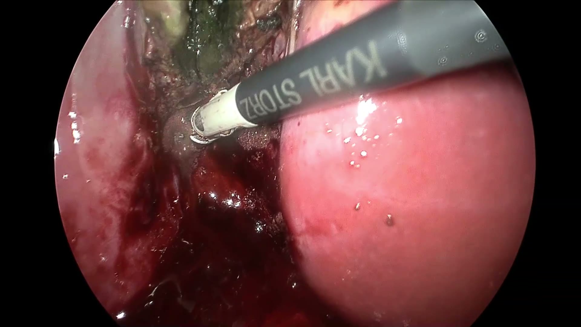 surgical still